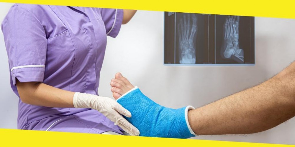 Top Myths About Bone Fractures