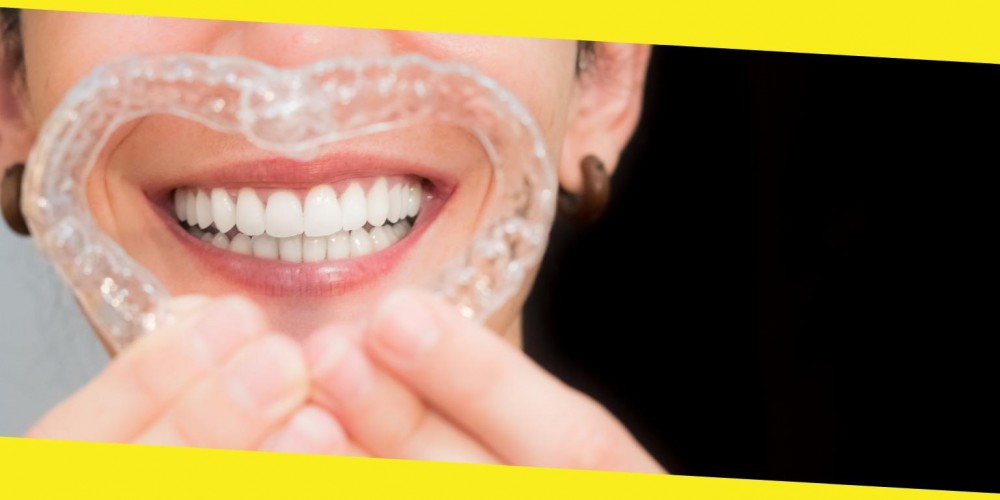 5 Favorite Tips on Handling Invisible Aligners